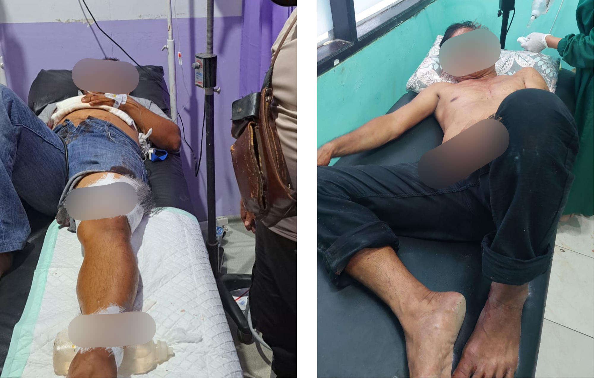 Saling Tatap Berakhir Cekcok, Dua Pria di Kaltim Dilarikan ke Rumah Sakit